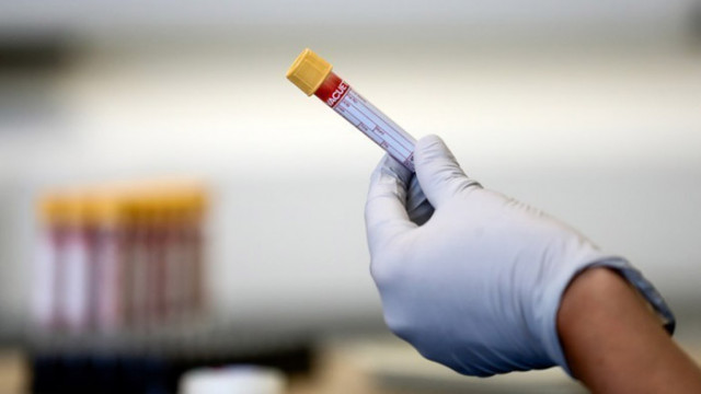 Футболист на ЦСКА е с COVID-19